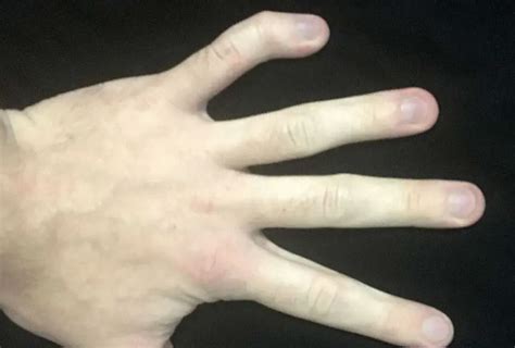 nattygonewild