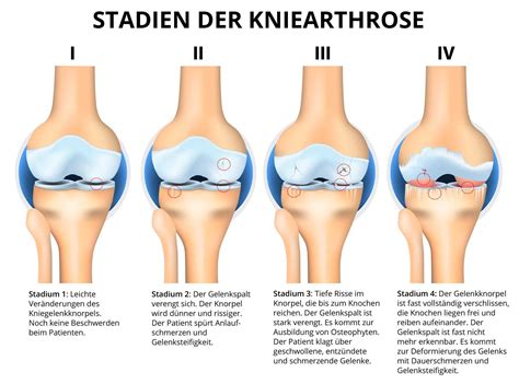 tony onlyfans nude